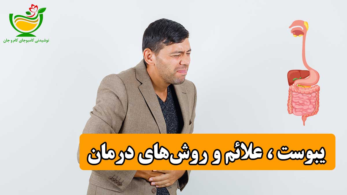 یبوست چیست و روش درمان آن چگونه است؟