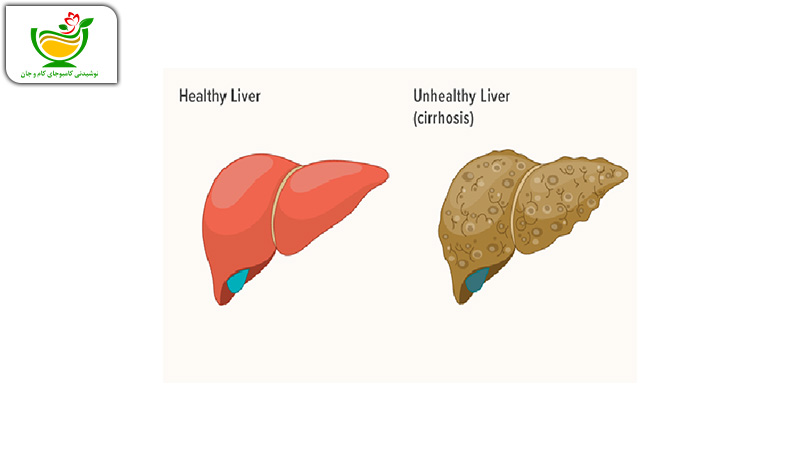 مقایسه کبد سالم و بیمار