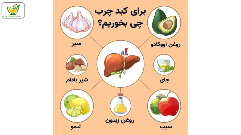 درمان قطعی کبد چرب گرید 2