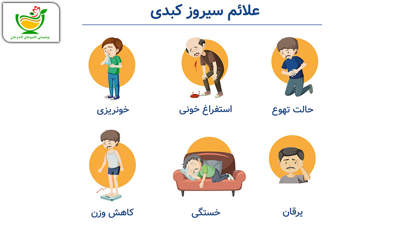 علائم سیروز کبدی